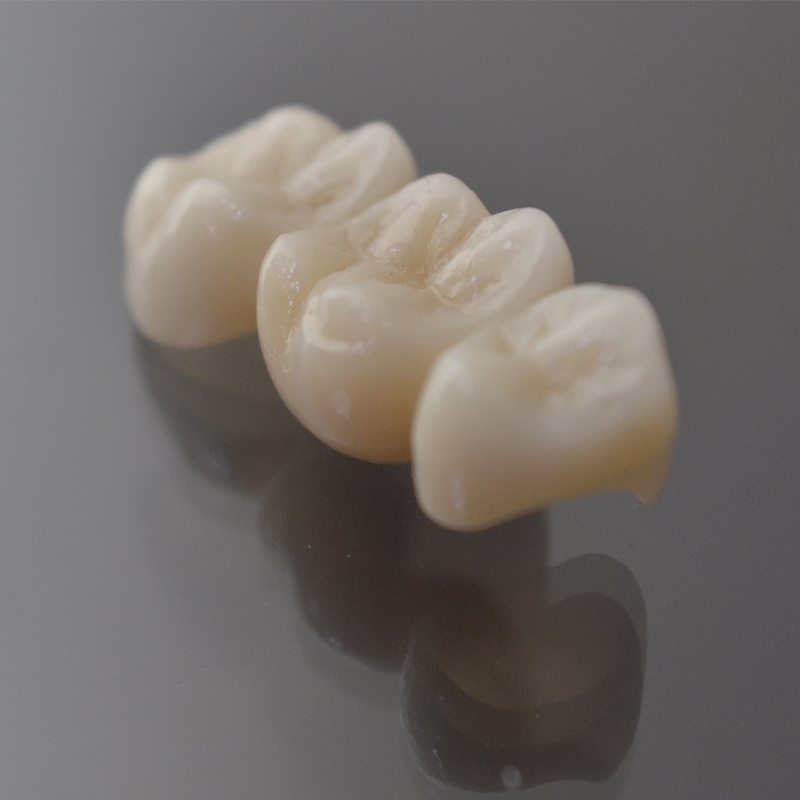 Vlastnosti koruny Zirconia Crown