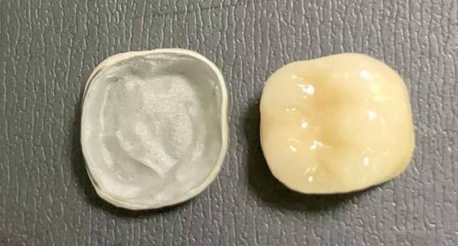 Jaké podmínky jsou vyžadovány pro získání porcelánových korun?