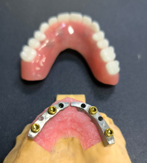 Lokátor a Titanium Dental Bar