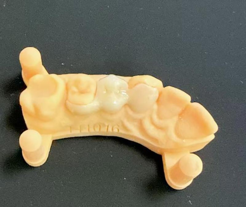 Co potřebujete vědět o Maryland Bridges?