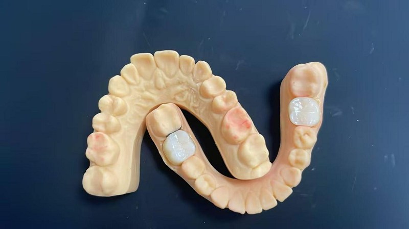 Co je to okraj ramene?