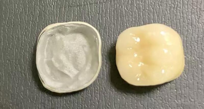 WM DENTAL LAB – přední čínská zubní laboratoř