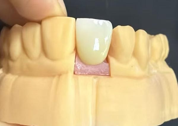 Mezery mezi zuby lze opravit — rovné zuby jsou nejatraktivnější!