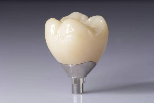 Optimalizujte své výsledky pomocí zirkoniových výplní (korunky, můstky, implantáty)