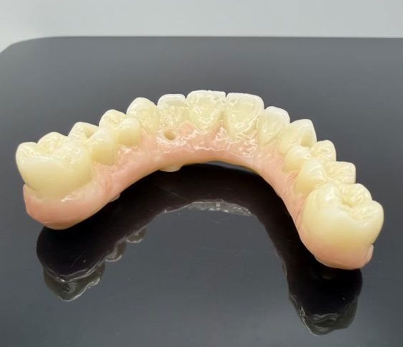 Běžné materiály pro zubní korunky a můstky