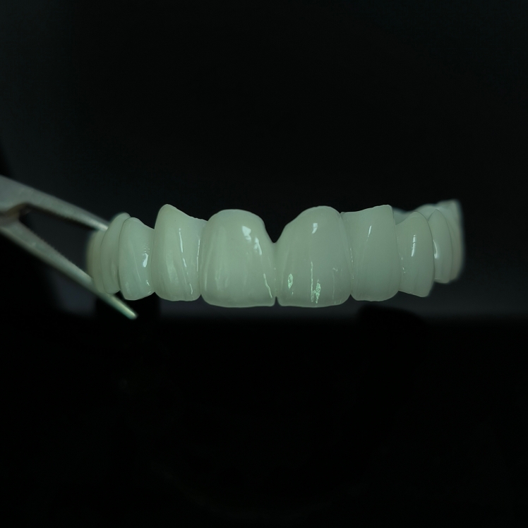 High Translucent Zirconia Bridge Layered Zirconia China Práce zubní laboratoře