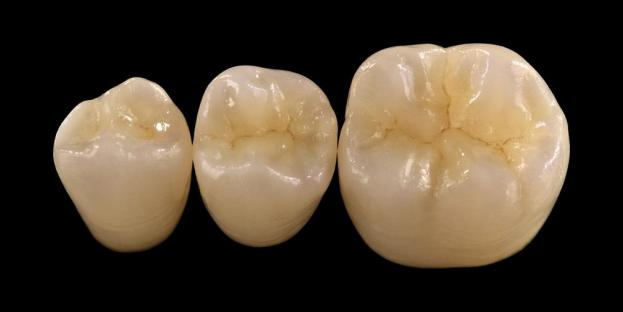 <h2>Zirkonie ve stomatologii: Indikace, výhody a klinické úvahy</h2>
<p>Zirkonie je široce uznávána pro svou pevnost a odolnost. Nejnovější generace zirkonových materiálů také nabízejí výrazně vylepšené estetické vlastnosti. U pacientů zvažujících celokeramické náhrady je nezbytné pečlivě zhodnotit indikace i omezení systémů na bázi oxidu zirkoničitého.</p>
<p>Dnešní pacienti stále více očekávají výplně, které kombinují vynikající estetiku s plně funkčním výkonem. Většina moderních keramických systémů může tato očekávání splnit, ale klinický úspěch do značné míry závisí na správném výběru materiálu, preparaci zubu a cementačních protokolech. Výběr by se měl řídit klíčovými vlastnostmi materiálu, jako je odolnost proti lomu, pevnost v ohybu, odolnost proti opotřebení a dlouhodobá stabilita. Mezi těmito materiály se oxid zirkoničitý stal jednou z nejpoužívanějších možností v současné záchovné stomatologii.</p>
<h3>Proč si vybrat zirkonie?</h3>
<p>Zirkonie je ceněna pro svou výjimečnou pevnost a dlouhodobou odolnost. Moderní zirkonie se výrazně liší od dřívějších generací, které byly více neprůhledné a méně estetické. Technologie CAD/CAM dnes umožňuje přesnou výrobu zirkoniových náhrad se zlepšenými optickými vlastnostmi.</p>
<p>Rekonstrukce mohou být navrženy jako:</p>
<ul>
<li><strong>Monolitický zirkon:</strong>Ideální pro zadní korunky a můstky, nabízí vysokou pevnost a odolnost.</li>
<li><strong>Vrstvené zirkony:</strong>Vhodné pro případy vyžadující zvýšenou estetiku, včetně dlouhých náhrad v různých oblastech úst.</li>
</ul>
<p>Pevnost v ohybu se liší v závislosti na typu a pohybuje se od přibližně 590 MPa u vysoce translucentního oxidu zirkoničitého až po 1400 MPa u monolitických forem. Zirkonové náhrady lze cementovat pomocí samolepicích pryskyřičných cementů nebo pryskyřicí modifikovaných skloionomerních cementů.</p>
<h3>Klíčové faktory při výběru materiálu oxidu zirkoničitého</h3>
<p>Při zvažování oxidu zirkoničitého pro celokeramickou náhradu by lékaři měli zhodnotit několik kritických faktorů:</p>
<ul>
<li>Zbývající struktura zubu</li>
<li>Umístění v dutině ústní (estetická zóna versus funkční zóna)</li>
<li>Přítomnost parafunkčních návyků, jako je bruxismus</li>
<li>Translucence sousedních přirozených zubů</li>
<li>Barva a stav základní struktury zubu</li>
</ul>
<p>Estetická zóna typicky zahrnuje přední zuby, i když u některých pacientů se může rozšířit až k prvnímu moláru v závislosti na linii úsměvu a dynamice obličeje. Funkční zóna obecně zahrnuje premoláry a moláry, kde jsou okluzní síly výrazně vyšší.</p>
<h3>Aplikace funkční zóny</h3>
<p>V zadních oblastech je třeba pečlivě zvážit okluzní síly. Zirkonium je vynikající alternativou k tradičním PFM náhradám, zejména v případech s omezeným výplňovým prostorem. Moderní monolitický oxid zirkoničitý umožňuje celokonturový design okluzní anatomie, včetně funkčních hrbolků a okrajových hřebenů, při zachování vysoké pevnosti.</p>
<p>Současné důkazy ukazují, že monolitický oxid zirkoničitý se dobře hodí pro posteriorní korunky a vícejednotkové můstky díky své vynikající odolnosti proti zlomení a opotřebení. Pokroky v adhezivních technikách a designu přípravy také zlepšily dlouhodobé klinické výsledky.</p>
<h3>Aplikace estetické zóny</h3>
<p>V přední oblasti musí výplně přesně kopírovat přirozenou barvu zubu, průsvitnost a světelné chování. Zatímco materiály jako lithium disilikát nabízejí vynikající estetiku, jsou méně pevné a obvykle vyžadují lepení.</p>
<p>Klíčovou výhodou oxidu zirkoničitého je jeho schopnost konvenčního cementování při zachování vysokého estetického výkonu. Díky vývoji vysoce translucenčních a vícevrstvých zirkoniových systémů je nyní možné vyrábět náhrady, které věrně napodobují přirozený chrup.</p>
<p>Pokročilé techniky zpracování dále zlepšují optické vlastnosti a snižují nedokonalosti, které mohou ovlivnit propustnost světla a vzhled.</p>
<h3>Kombinace síly a estetiky</h3>
<p>Dřívější systémy zirkonu upřednostňovaly pevnost, ale postrádaly estetickou kvalitu. Moderní monolitický oxid zirkoničitý úspěšně kombinuje pevnost a vylepšený vzhled, díky čemuž je vhodný pro širokou škálu klinických případů.</p>
<p>Je zvláště přínosná pro pacienty s parafunkčními návyky nebo předchozími selháními obnovy. Klinické studie naznačují vysokou míru akceptace pacienty a nízkou míru komplikací.</p>
<p>Obavy z opotřebení protilehlého chrupu byly sníženy s novějšími formulacemi. Vysoce leštěné povrchy zirkonu vykazují nízký abrazivní potenciál a v některých případech mohou být šetrnější než tradiční náhrady z porcelánu taveného na kov.</p>
<h3>Zirkonové implantáty: vznikající alternativa</h3>
<p>Zatímco titanové implantáty zůstávají klinickým standardem, zirkoniové implantáty si získávají pozornost jako bezkovová alternativa. Dřívější návrhy byly primárně jednodílné systémy, ale dvoudílné zirkonové implantáty nyní umožňují lepší flexibilitu protetiky.</p>
<p>Zirkoniové implantáty jsou zvláště užitečné v případech, kdy existují estetické problémy, jako je potenciální šedé zbarvení periimplantátových tkání nebo tenký gingivální biotyp. Mohou být také zváženy u pacientů se vzácnou citlivostí na titan.</p>
<p>Zirkoniové implantáty jsou však stále relativně nové a dlouhodobá klinická data zůstávají ve srovnání s titanovými systémy omezená.</p>
<h3>Závěr</h3>
<p>Zirkony se vyvinuly ve vysoce všestranný materiál v záchovné stomatologii, který nabízí silnou rovnováhu mezi mechanickým výkonem a estetikou. Správný výběr případu a dodržování klinických protokolů jsou zásadní pro dosažení optimálních výsledků v přední i zadní aplikaci.</p>