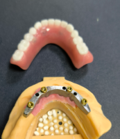 Lokátor a zubní lišta