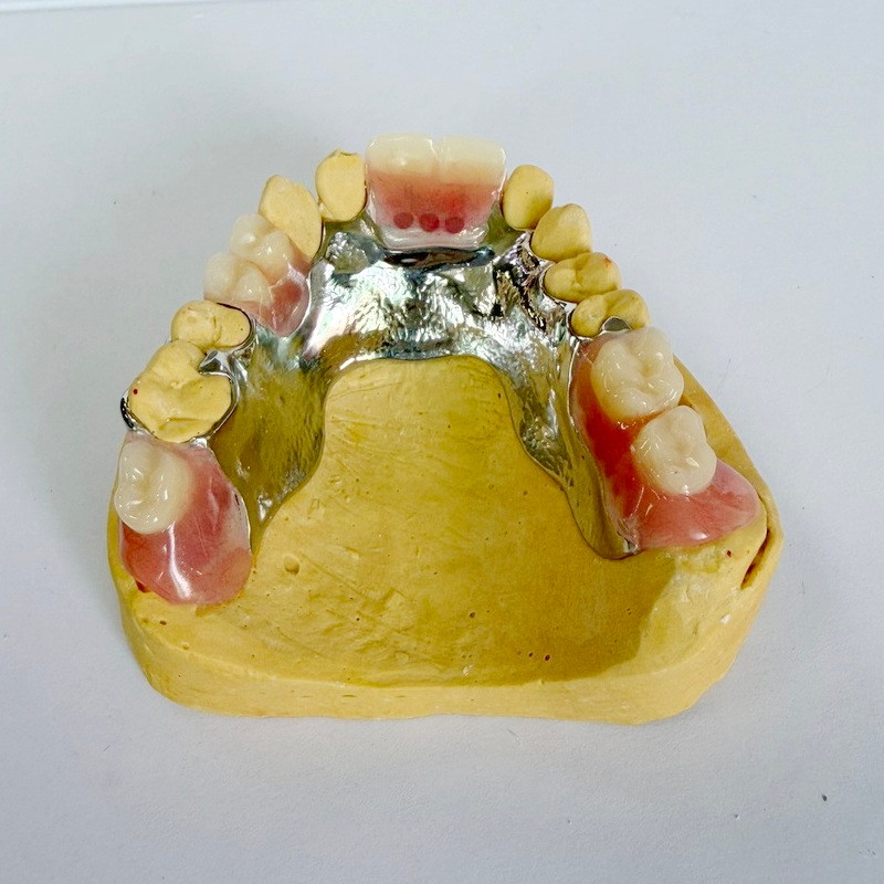 Odnímatelný částečný rámec obnovy